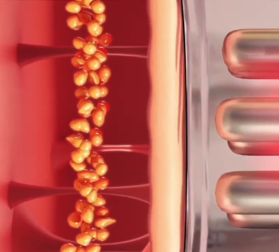 LuminaSculpt™ – Dispositivo de Belleza 4 en 1 con Succión, EMS y Luz Roja